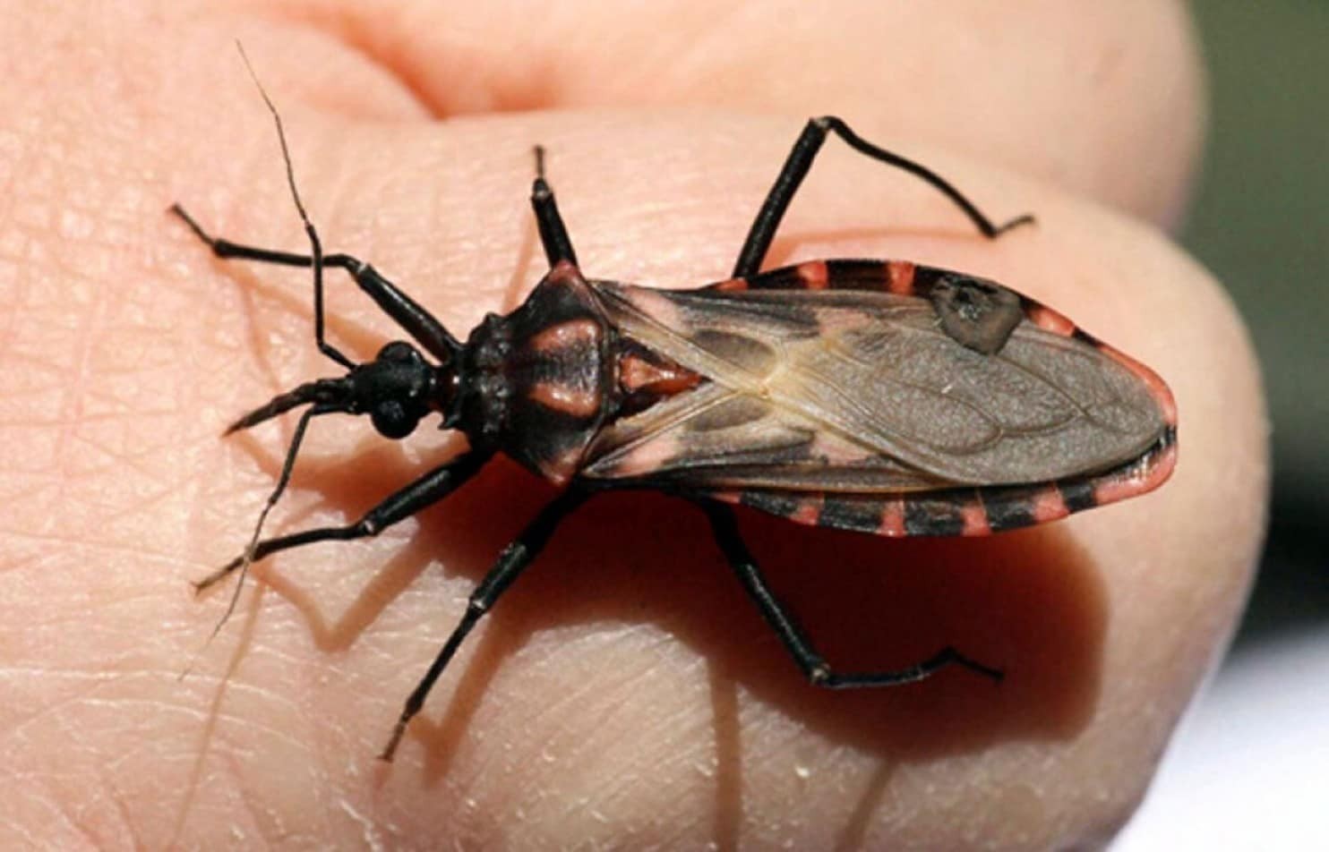Piura: registran el primer caso de Chagas enfermedad de chagas