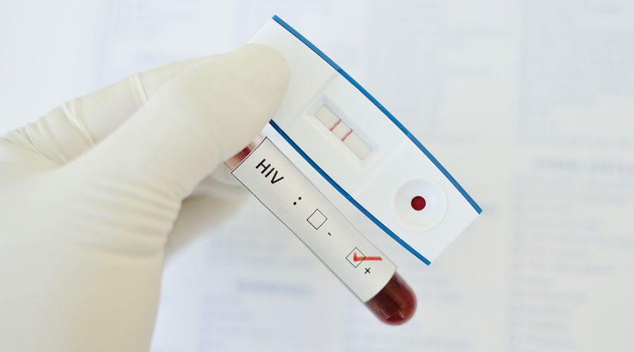 Piura: once personas con VIH fallecieron por contagio de Covid-19