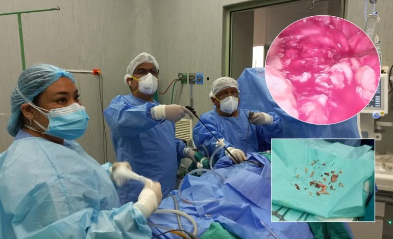 Cirujanos del Hospital Santa Rosa realizan primera torascopía y bebé se recupera satisfactoriamente