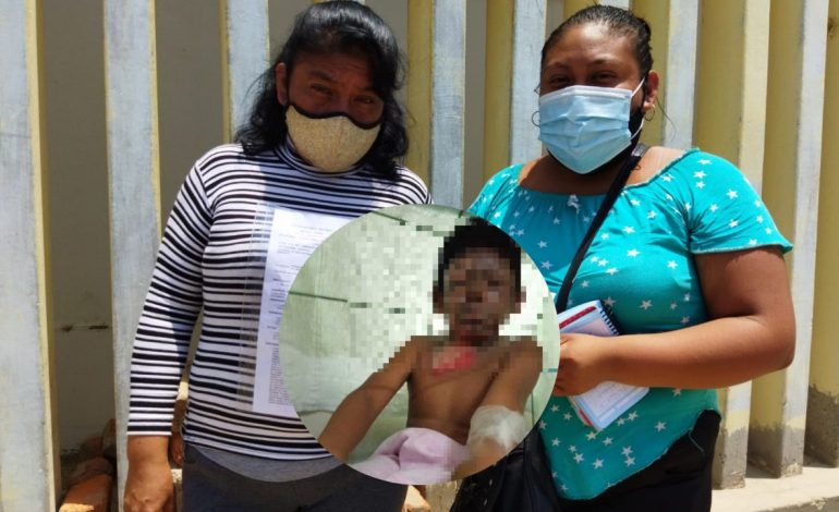 Piura: familiares de niño con quemaduras de tercer grado piden ayuda para su recuperación