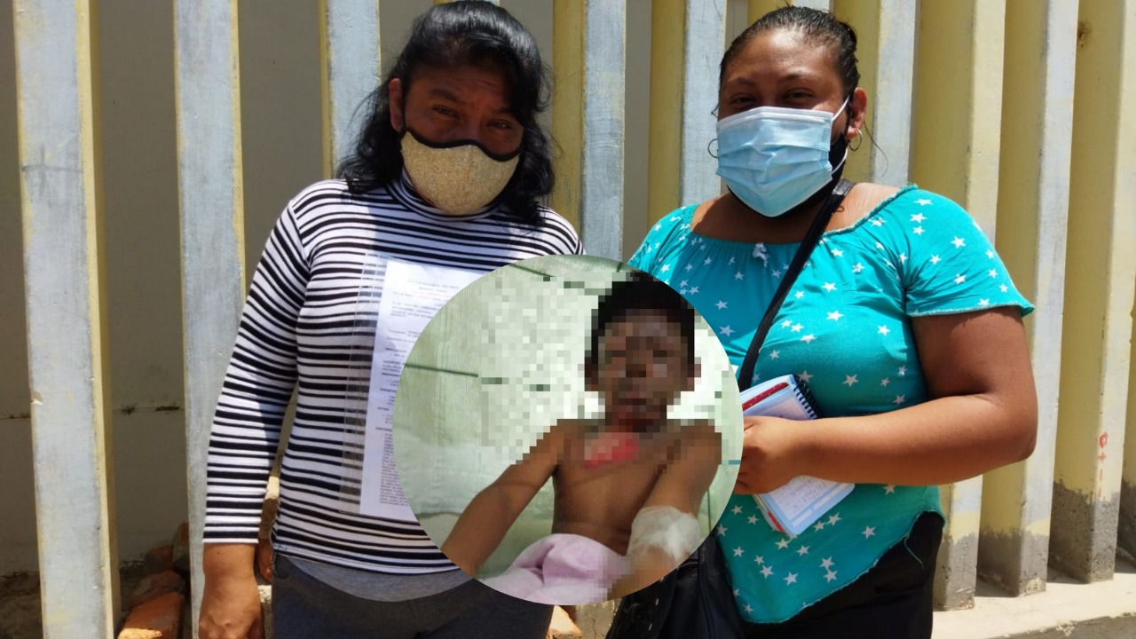 Piura: familiares de niño con quemaduras de tercer grado piden ayuda para su recuperación