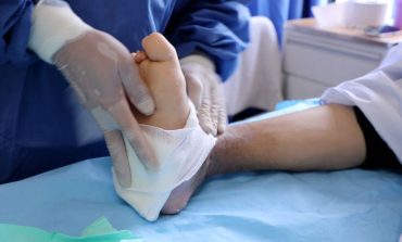 Diabetes: conoce los nuevos procedimientos que evitan la amputación de piernas
