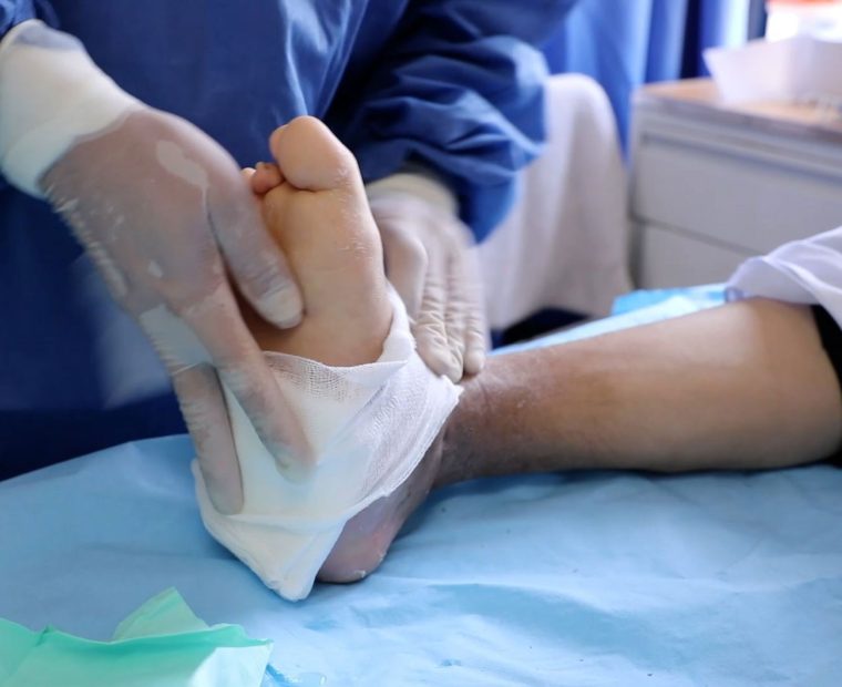 Diabetes: conoce los nuevos procedimientos que evitan la amputación de piernas