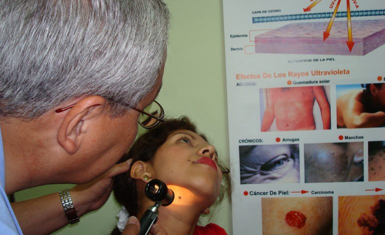 Ciderm realizará campaña gratuita de prevención y detección de cáncer de piel en Piura