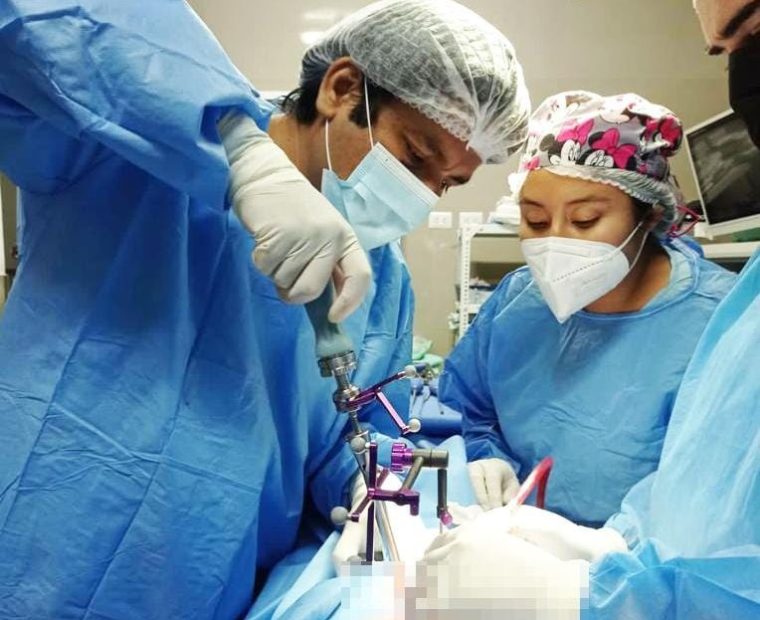 Sullana: primera cirugía de columna con uso de neuronavegador se realiza con éxito