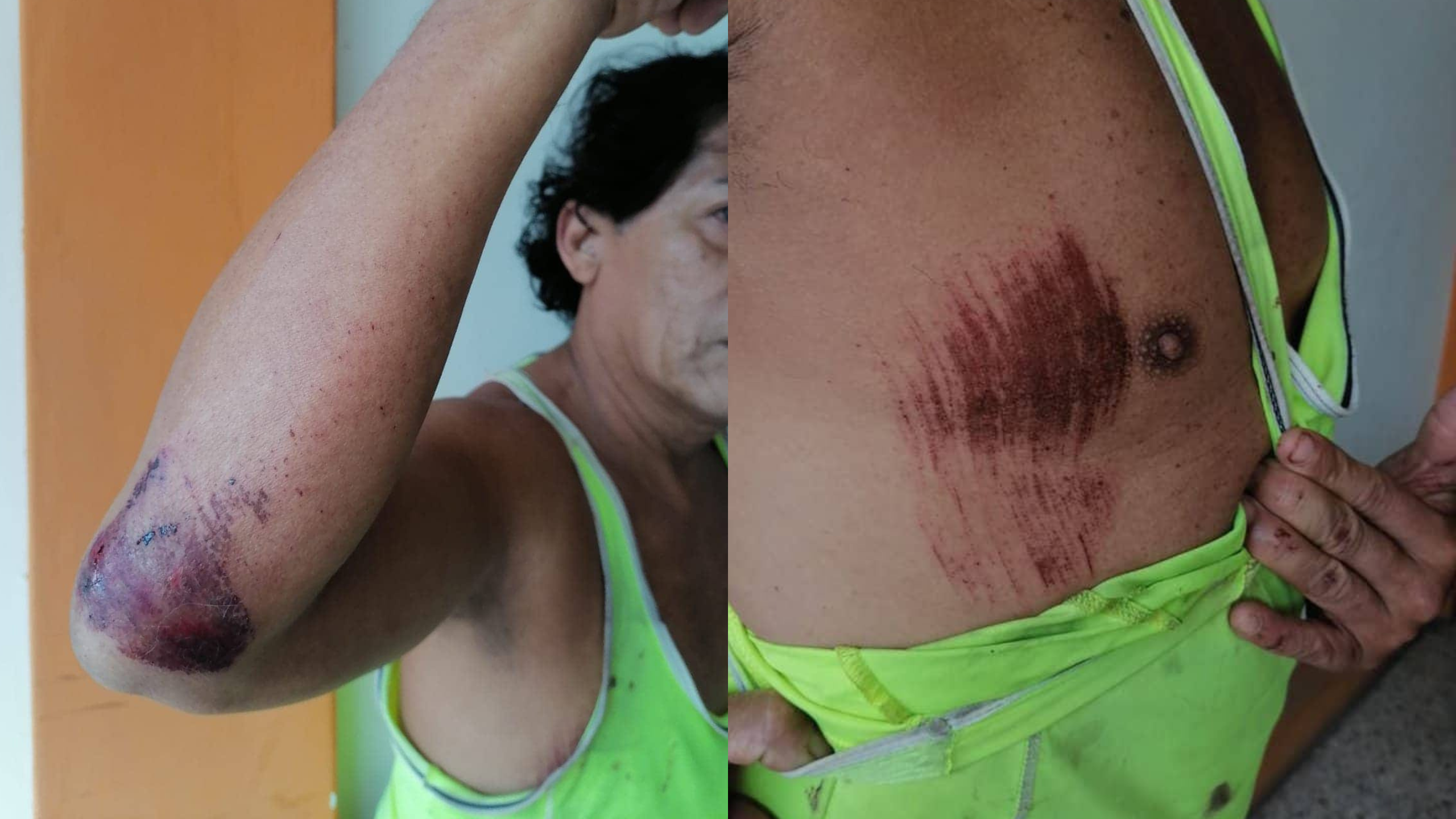 Piura: integrante de la comunidad LGBT denuncia agresión por parte de desconocidos