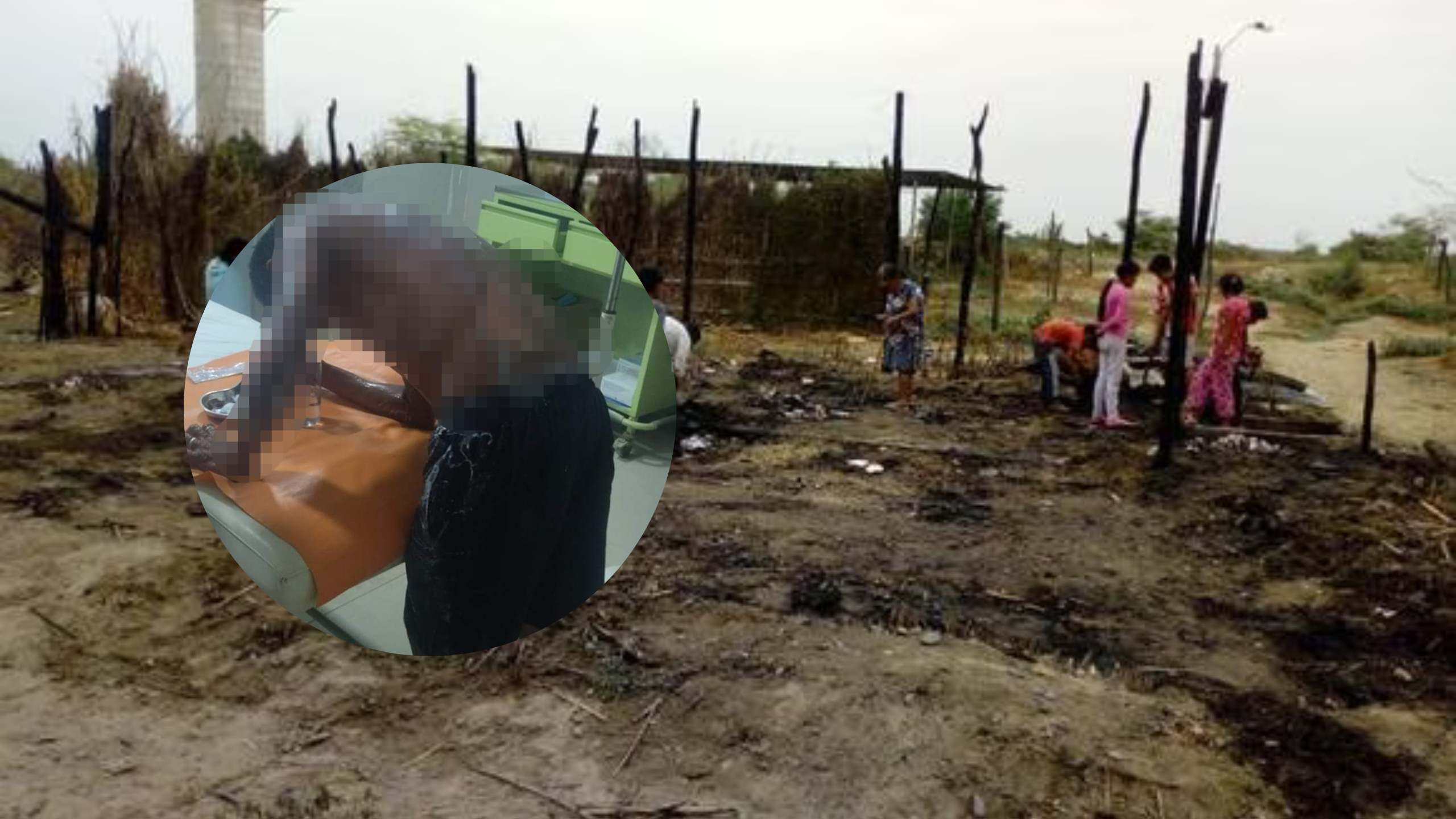 Piura: Padre sufre quemaduras de tercer grado por salvar a su hijo