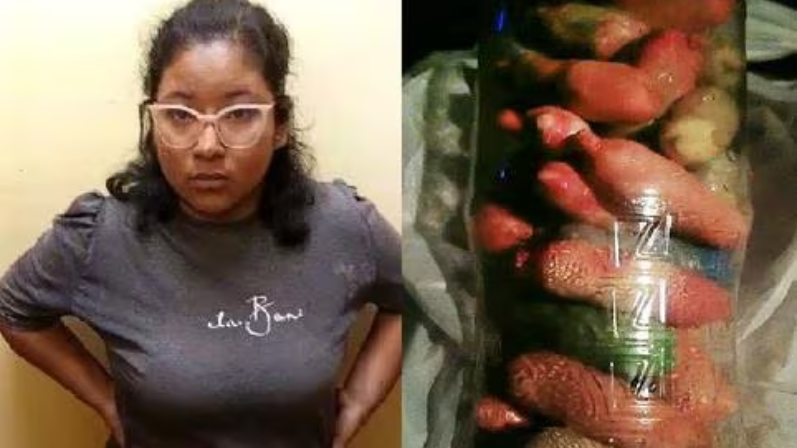 Piura: descubren a joven intentando ingresar drogas en su estómago al penal