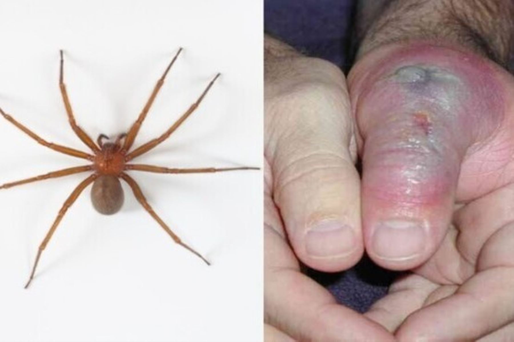 Aumentan casos de mordeduras por araña casera en temporada de invierno
