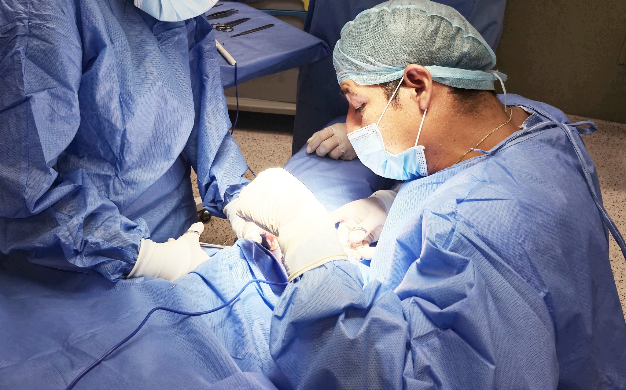 Sullana: Bebé operado con éxito por complicación estomacal