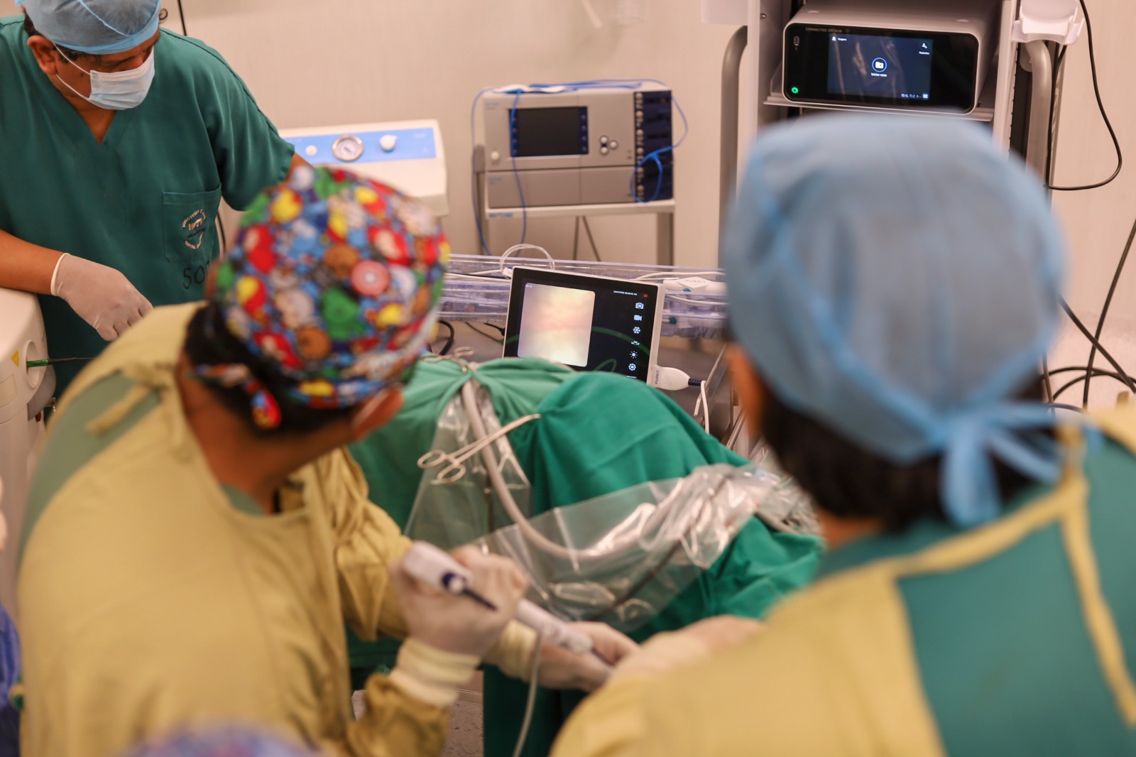 Piura: Médicos eliminan cálculo renal con tratamiento láser